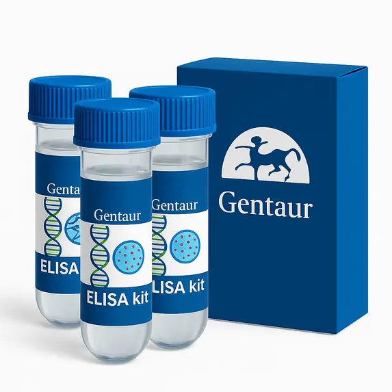 Retinol Binding Protein (RBP4) ELISA Kit - 96 Wells
